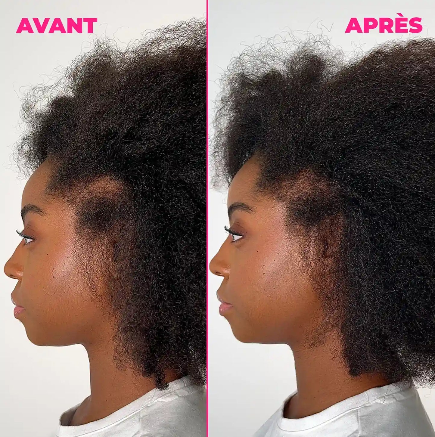 Kurl Hero - Sérum anti-chute, croissance et densifiant